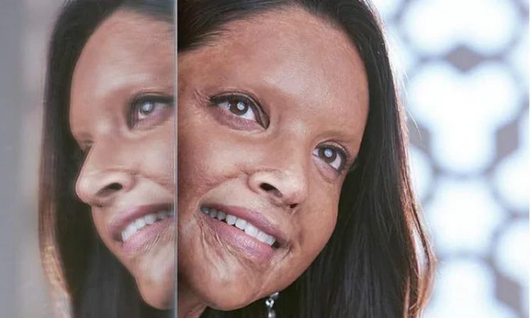 অ্যাসিডে আক্রান্ত দীপিকা, ট্রেলারেই বাজিমাত ‘ছাপাক’!